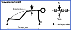 Provokationstest
